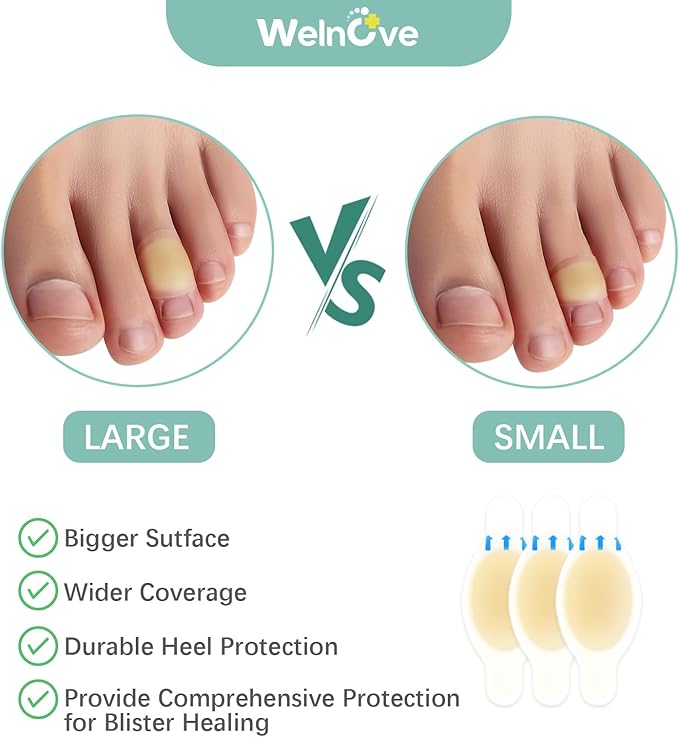 Gel Blister Bandages Hydrocolloid Bandages - Welnove 30ct Blister Cushions (Toe Pack) - Blister Bandages for Heel, Toe & Foot - Blister Pads for Prevention & Recovery - Water Resistant Bandages