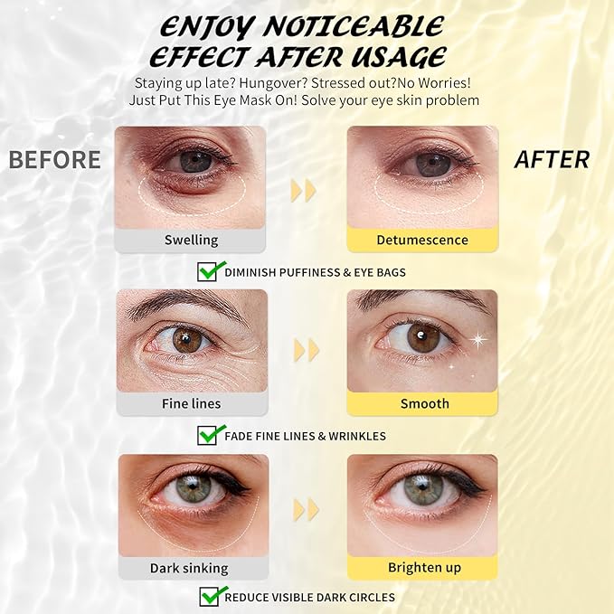 Maskiss Under Eye Patches (25 Pairs), Caffeine Eye Masks for Dark Circles Puffy Eyes Undereye Bags, Collagen Eye Patches for Wrinkles and Puffiness, Skin Care Gift for Her