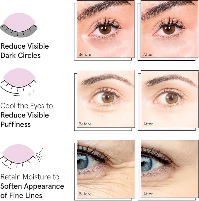 grace & stella Award Winning Under Eye Mask Reduce Dark Circles, Puffy Eyes, Undereye Bags, Wrinkles, Gel Under Eye Patches, Mothers Day Gifts Bulk, Gifts for Teens - Vegan Self Care (48 Pairs, Blue)