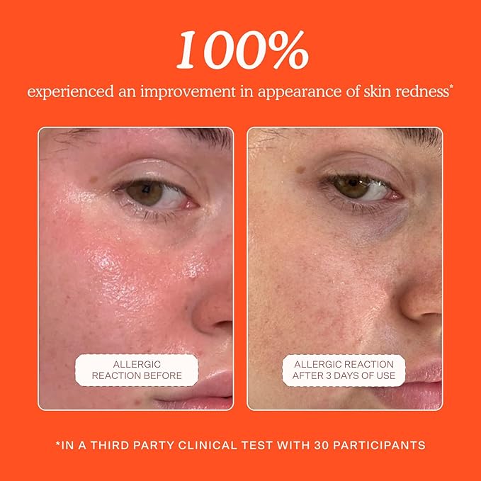 Tower 28 SOS Daily Rescue Facial Spray - Hypochlorous Acid Spray to Help Reduce Redness, Calm Irritation + Alleviate Flare-Ups - Soothing + Purifying Face Toner - Everyday Skin Care Essential (4 oz)