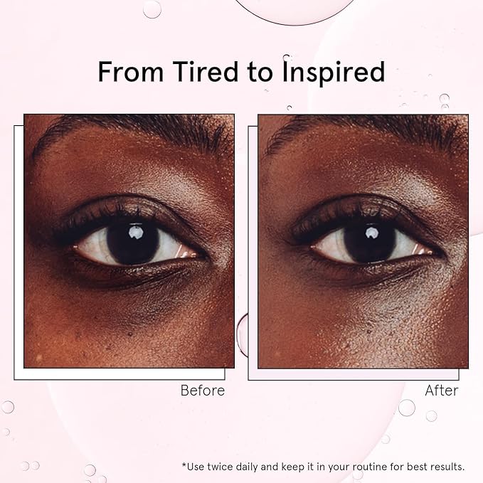 grace & stella Under Eye Brightener with Cooling Metal Rollerball - Centella Asiatica & Caffeine Eye Serum for Puffy Eyes - Travel Essentials - Under Eye Cream - Travel Essentials (15ml / 0.51floz)
